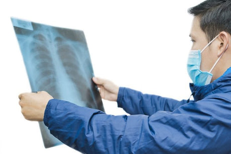 Can you get "Wet Lung" from an e-cigarette?